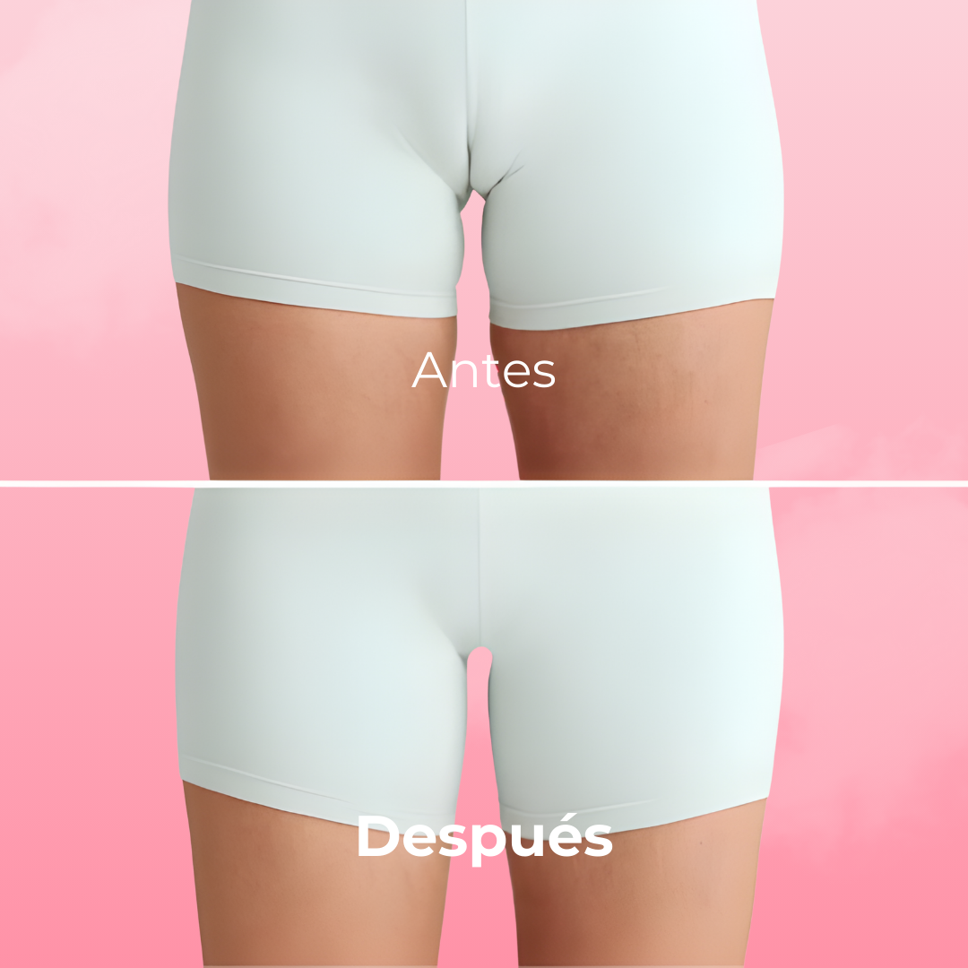 Anti-Camel Toe Thong